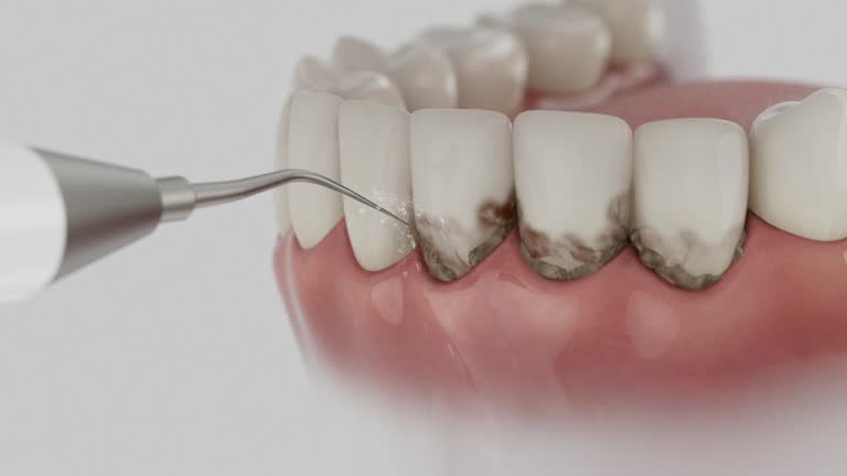 Reliable Dental Implants contractor in Cherryvale, KS by Smile Center Dentistry